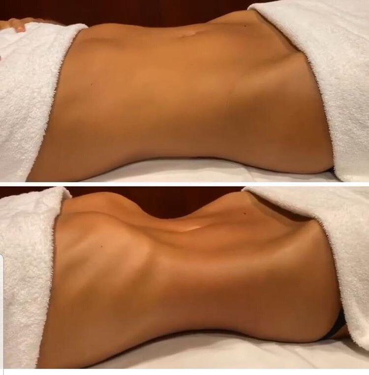 Massagem método Renata França 